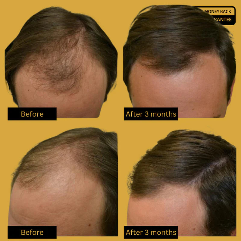 Purc™ Natural Hair Growth Oil