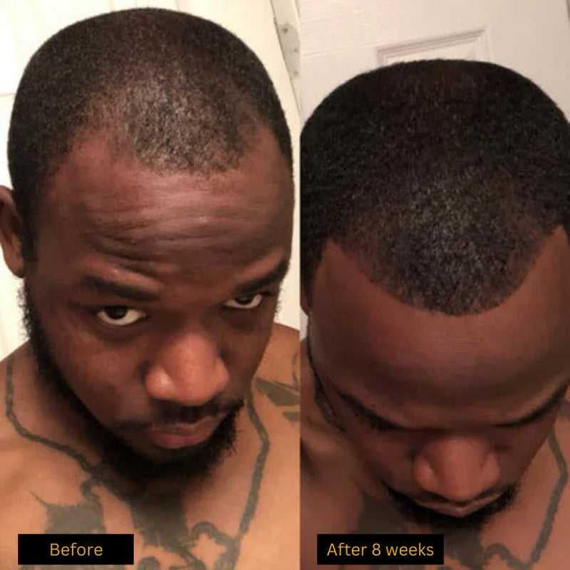 Purc™ Natural Hair Growth Oil